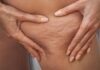 Following These Steps, You Can Get Rid Of Stubborn Fat And Cellulite Stubborn Fat And Cellulite