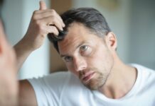 7 Imp Questions To Ask During Your Hair Loss Consultation Hair Loss