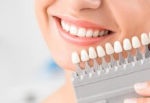 Understanding the Different Types of Cosmetic Dental Procedures Cosmetic Dental