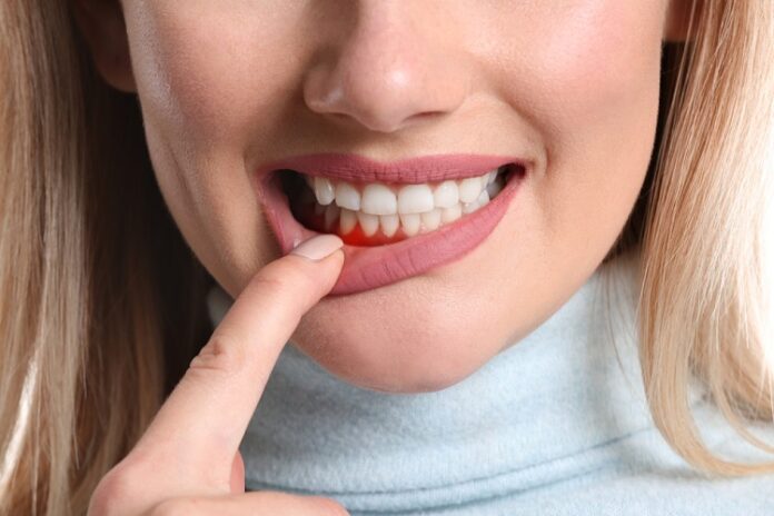 Periodontal Treatment Periodontal Treatment