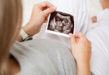 What Is Glossoptosis In A Fetus? Fetus